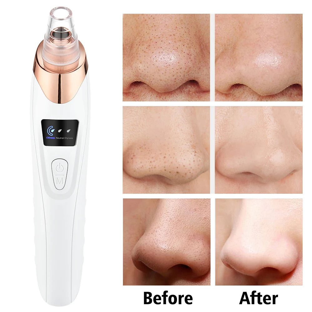 Facial Blackhead Remover Electric Pore Cleaner