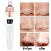 Facial Blackhead Remover Electric Pore Cleaner