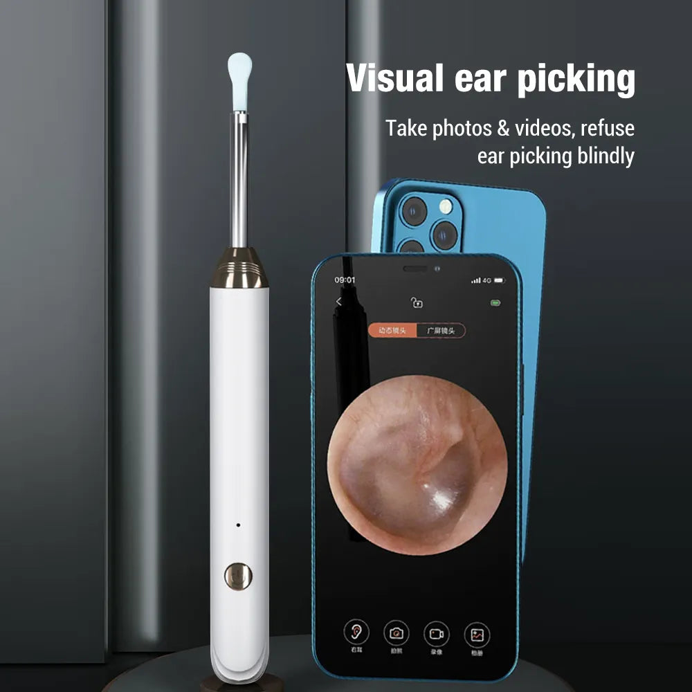 Wireless Ear Camera Luminous Otoscope