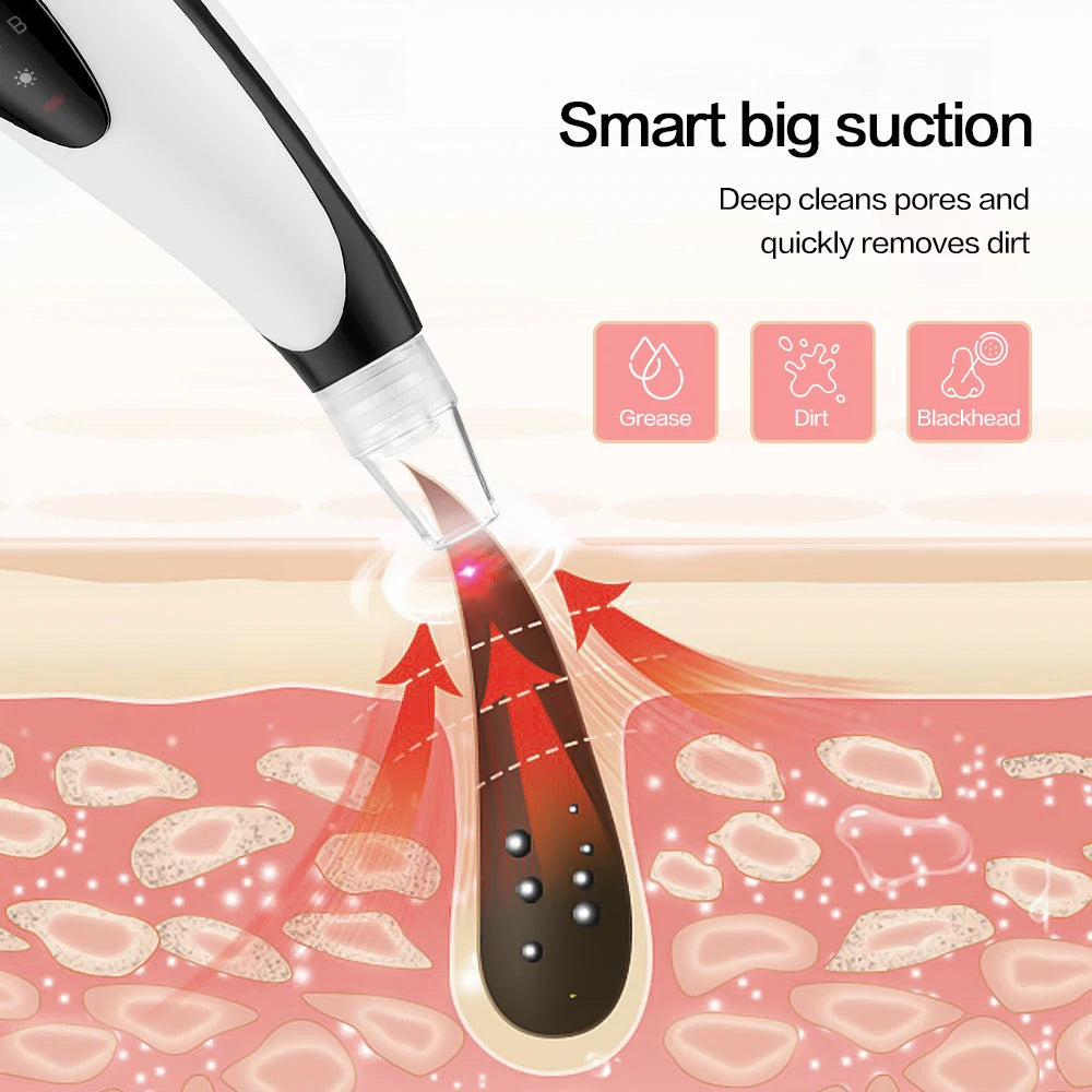 Blackhead Remover Face Pore Vacuum